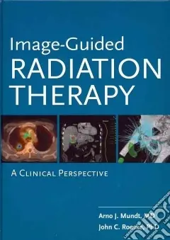 Offerta Image guided radiation therapy