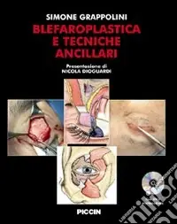 Blefaroplastica e tecniche ancillari. Con DVD Ultime Pezzi