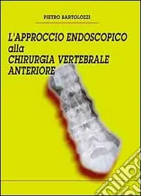 L‘approccio endoscopico alla chirurgia vertebrale anteriore Spedito Oggi