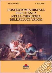L‘osteotomia distale percutanea della chirurgia dell‘alluce valgo Prezzo Di Fabbrica